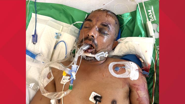 University Hospital asks for help identifying unconscious patient hit by truck Saturday evening — KENS 5 (San Antonio), San Ramon Health news